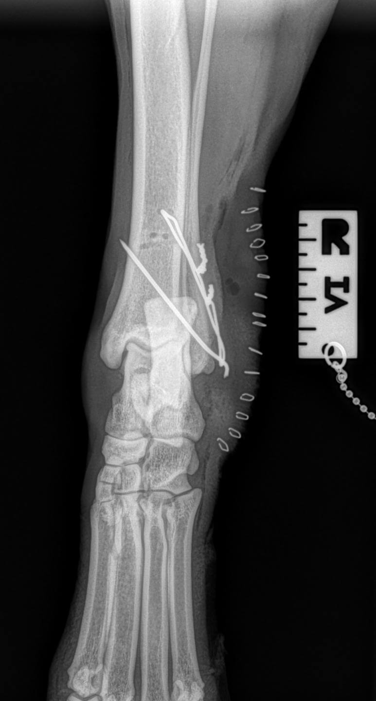 canine lateral malleolus fracture repair pin and tension band