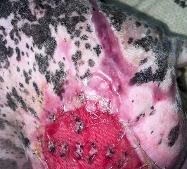 3 days after fish skin grafting and applying spray on skin cells and creating punch grafts