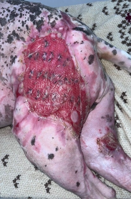 3 days after fish skin grafting and applying spray on skin cells and creating punch grafts