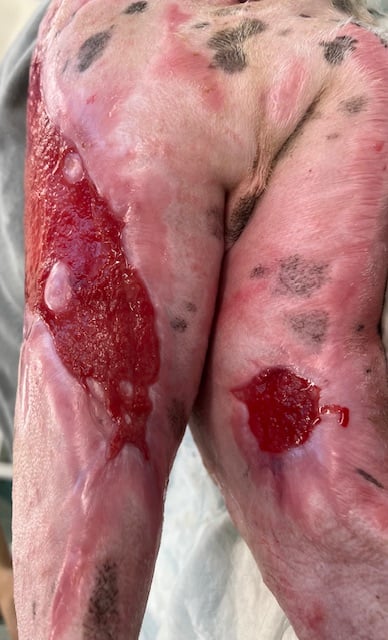 Day 56 Dog burn wounds before 3rd round of grafting