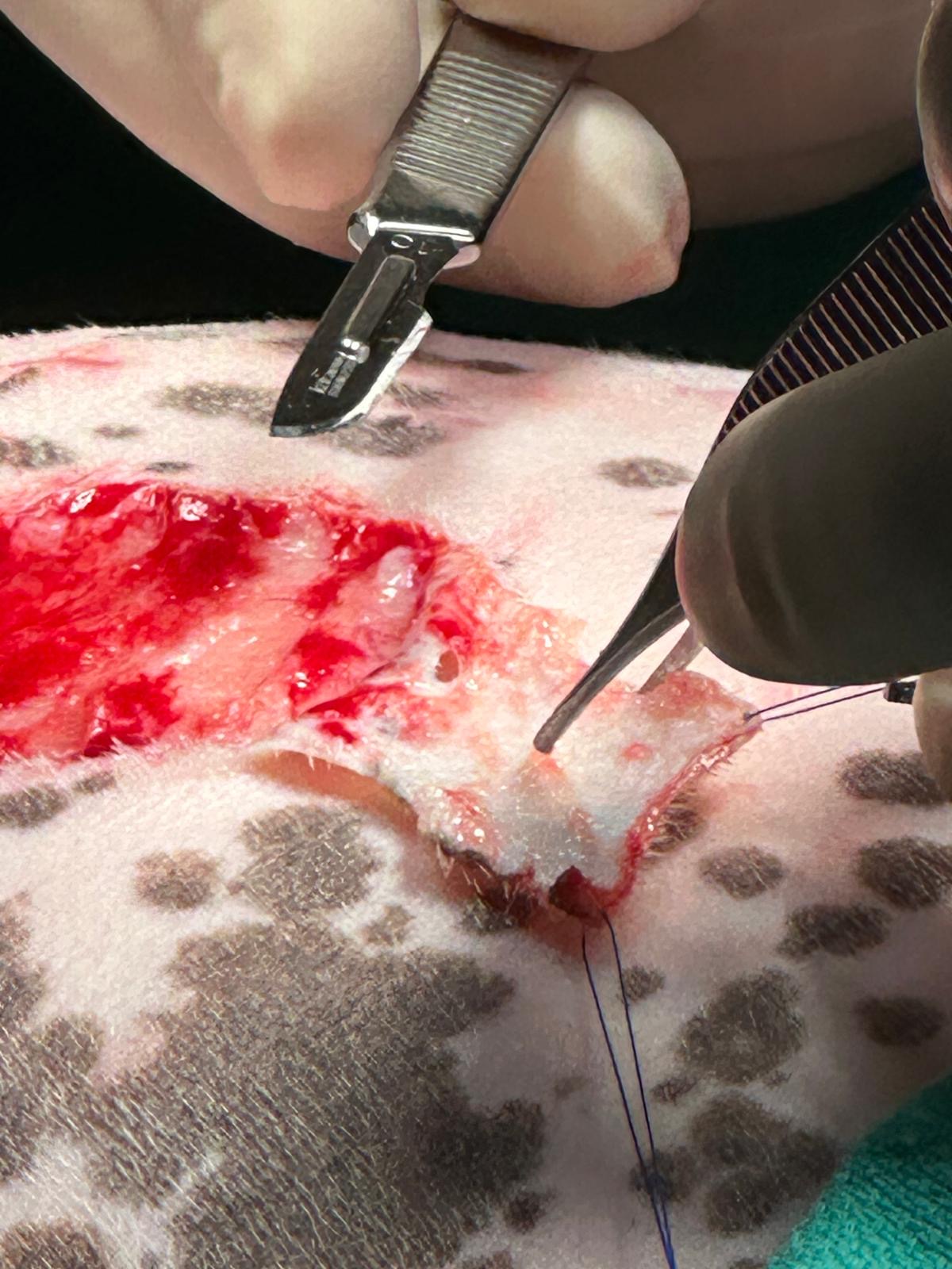 Obtaining partial thickness skin cells to create Spray on skin spray (Recell) Avita Medical