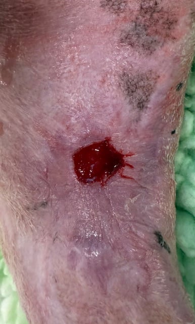 Dog burn wound right leg day 69