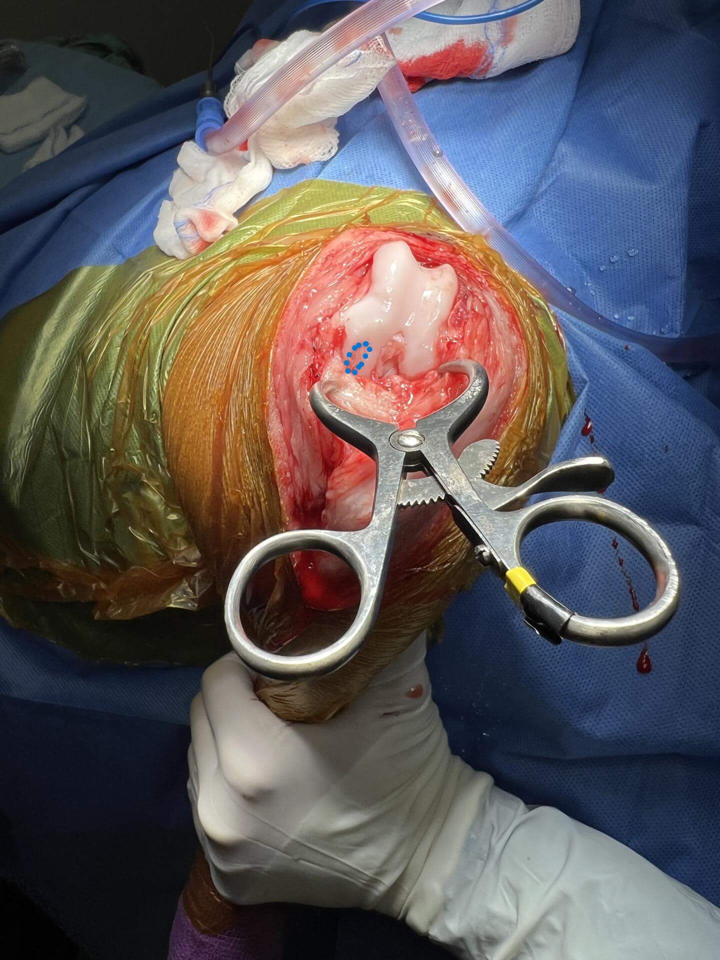 Canine OCD Stifle Lesion outlined with blue dotted line