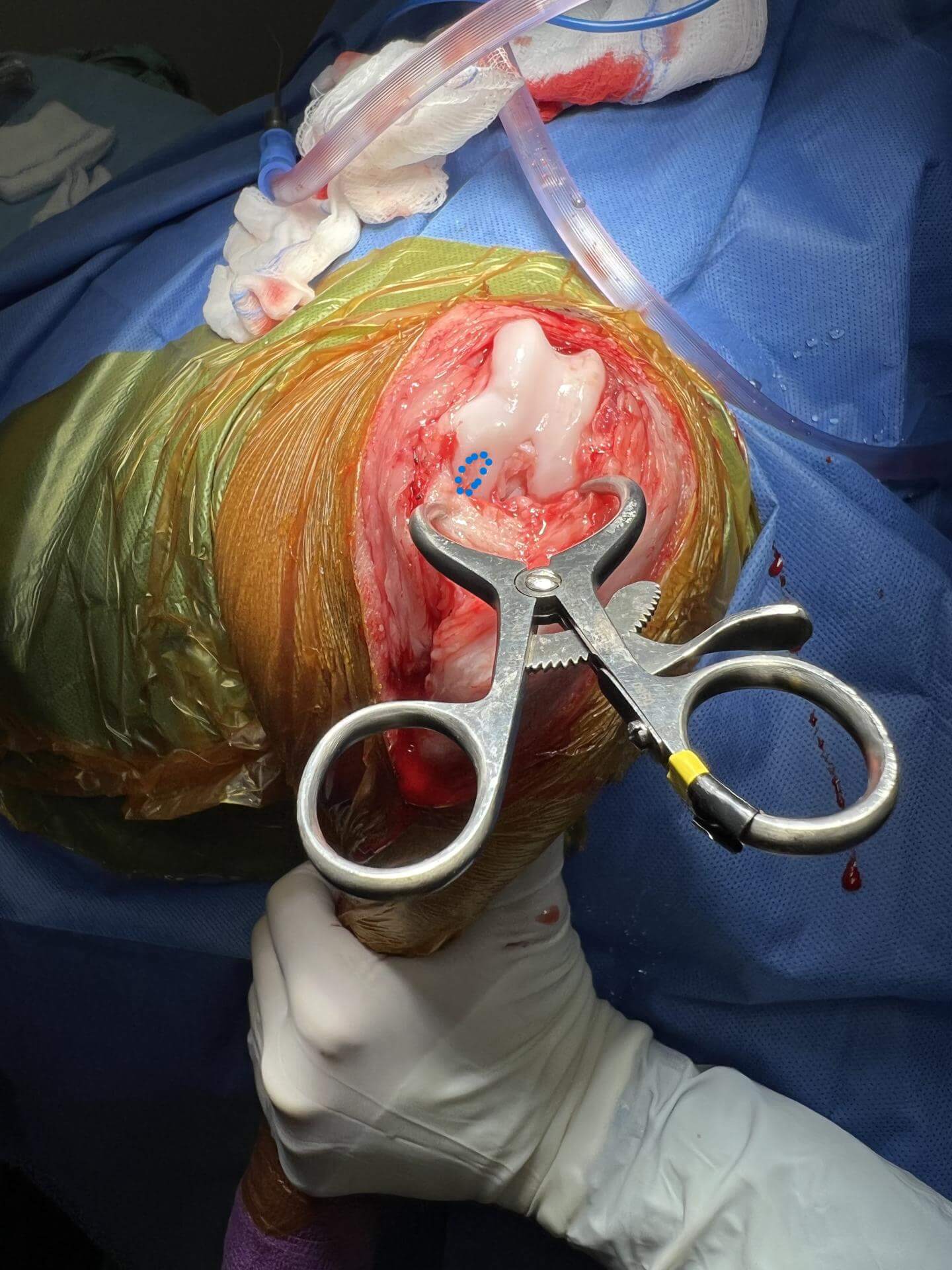 Canine OCD Stifle Lesion outlined with blue dotted line