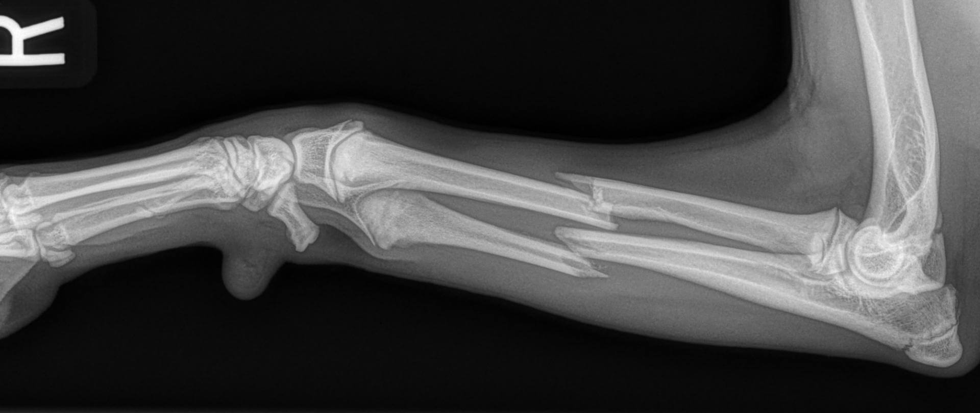 fractured canine radius ulnar