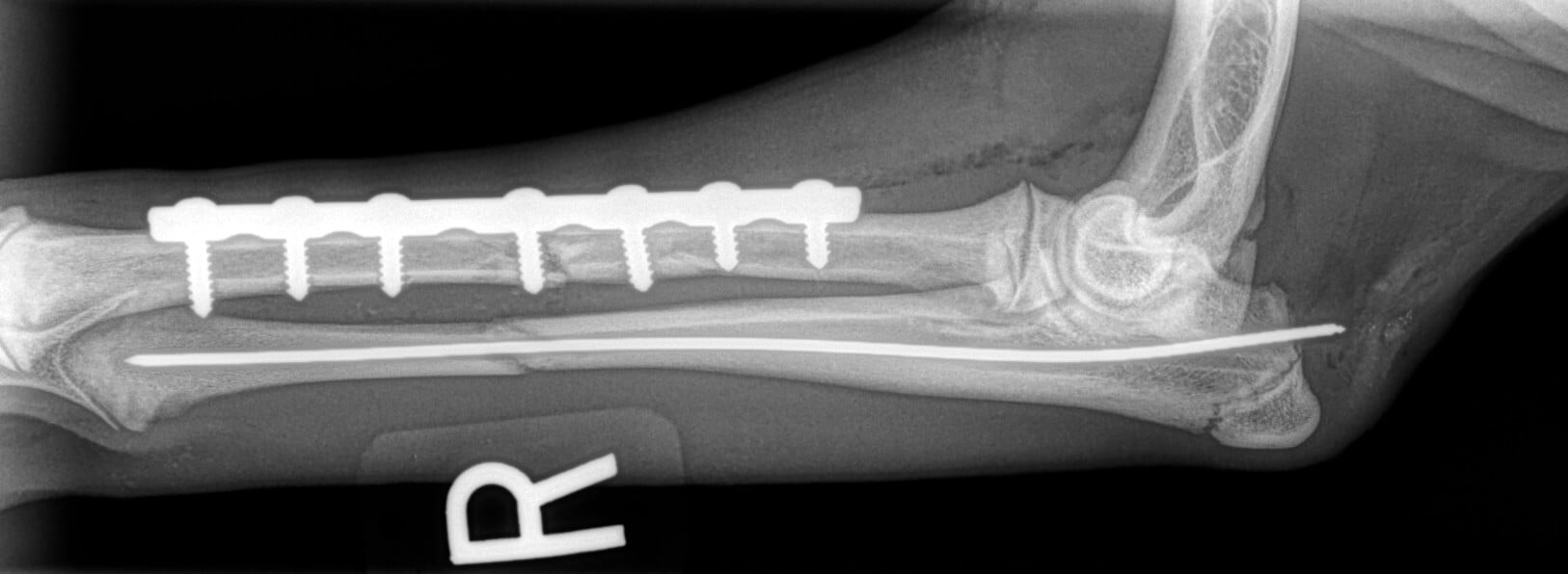 fractured canine radius and ulnar radial plate and ulnar pin