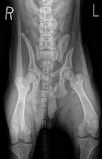 pelvic fracture sacroiliac SI luxation ilial body fracture