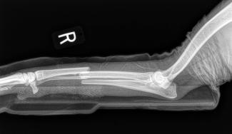 radius ulnar fracture dog lateral 