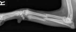 fractured canine radius ulnar