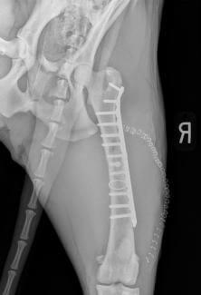 Femur fracture repaired pins
