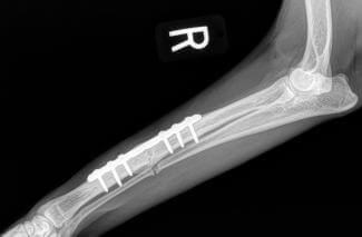 radius ulnar dog fracture plated